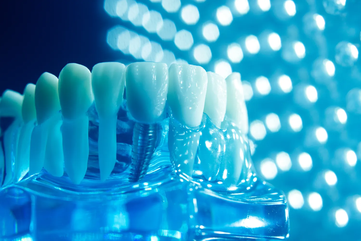 Protetyka cyfrowa Lublin