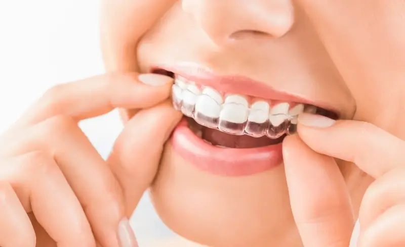 Jakie są rodzaje implantów zębowych?
