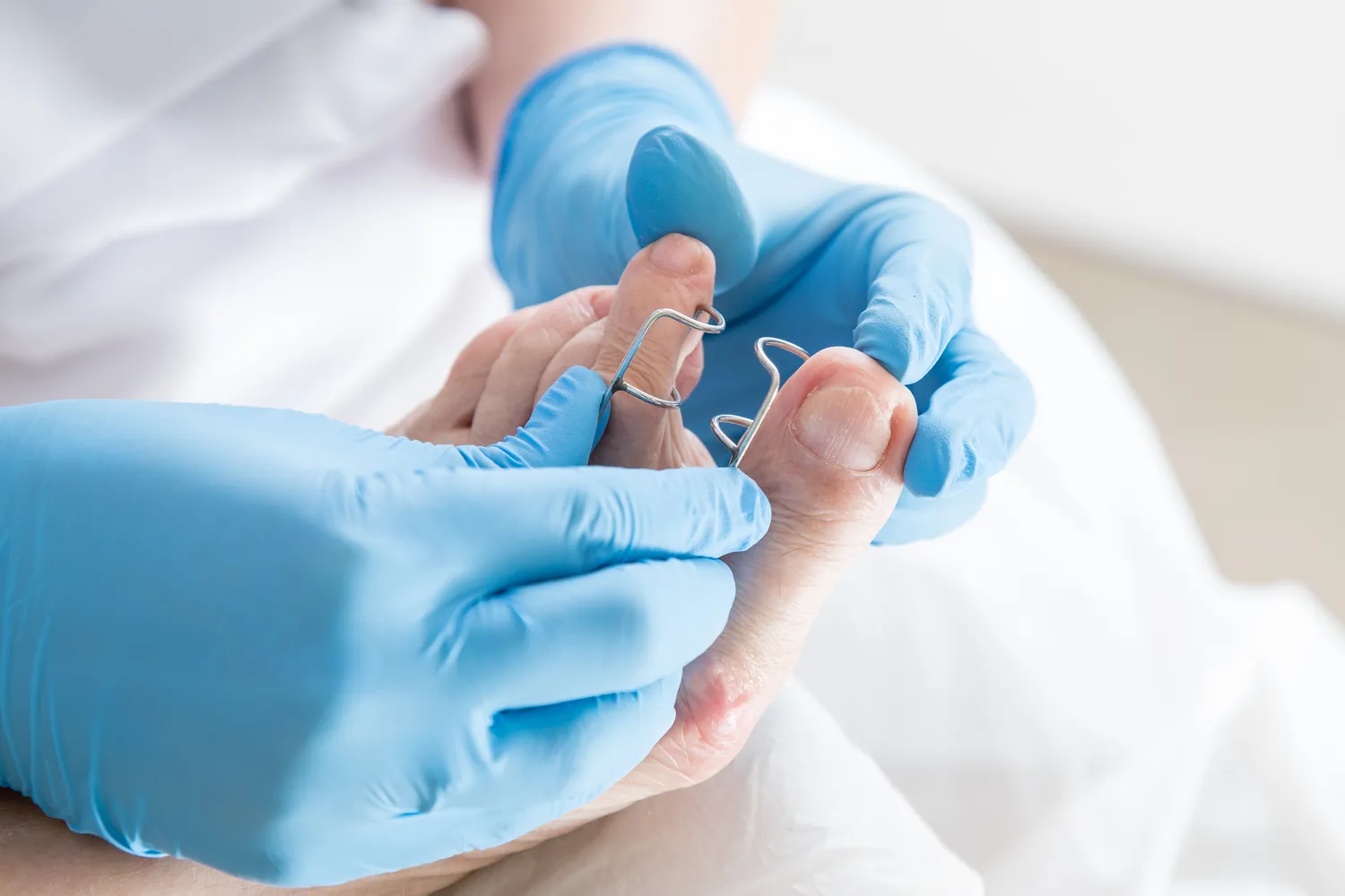 Pedicure leczniczy – co o nim wiedzieć warto?