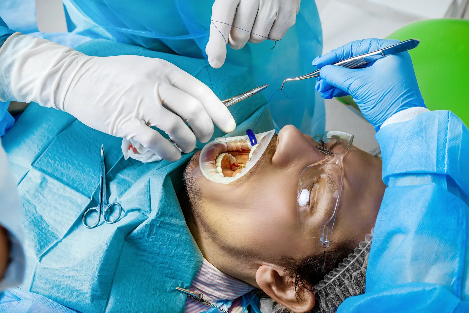 Czy leczenie kanałowe pod mikroskopem boli?