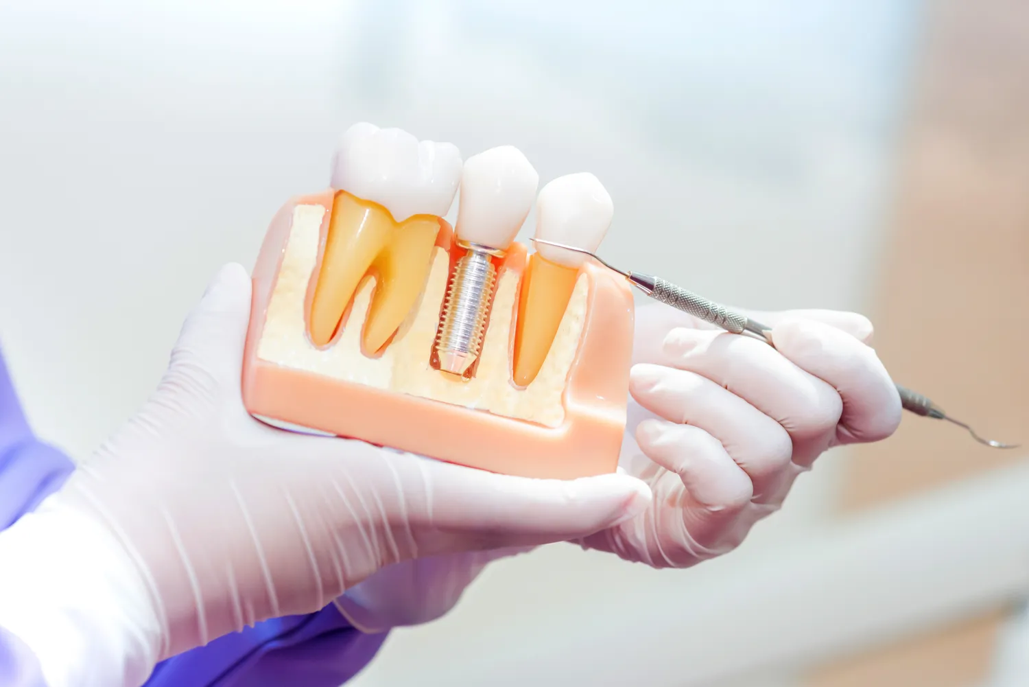 Endodoncja Szczecin