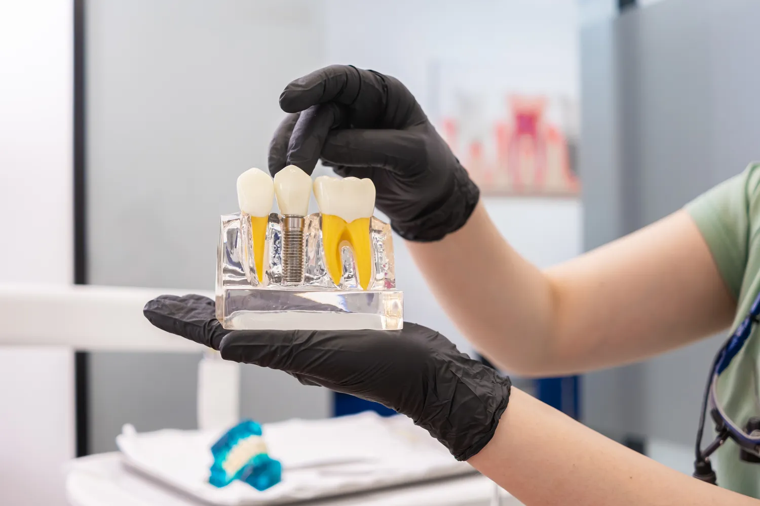 Kiedy kanałowe leczenie?